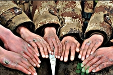 怎樣提前預(yù)防凍瘡比較有效？冬天預(yù)防凍瘡的小妙招