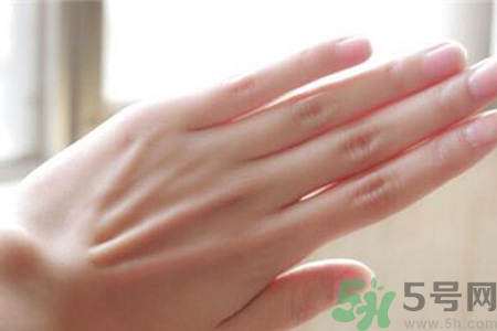 患凍瘡是身體缺什么嗎？長凍瘡是身體缺維生素嗎？