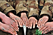 凍瘡為什么會(huì)癢？凍瘡發(fā)癢能用鹽水泡嗎？