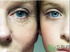 皮膚缺水有哪些癥狀?皮膚缺水會導(dǎo)致哪些問題?