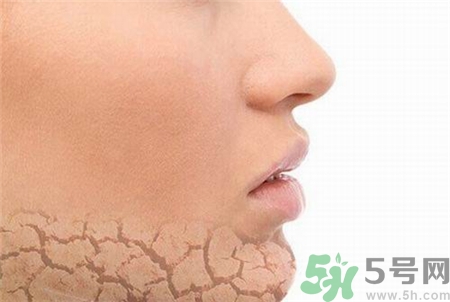 皮膚缺水有哪些癥狀?皮膚缺水會導(dǎo)致哪些問題?