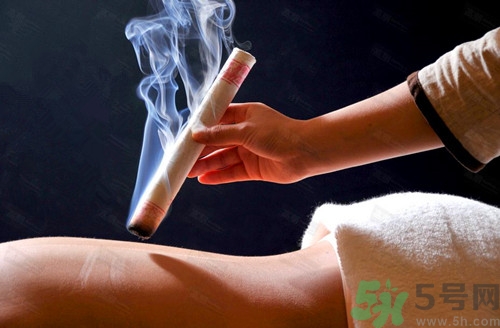 艾灸哪里可以減肥?艾灸減肥有效嗎 艾灸哪里可以減肥?艾灸減肥有效嗎