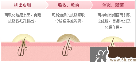 日本白兔牌暗瘡膏價格 白兔祛痘膏多少錢？