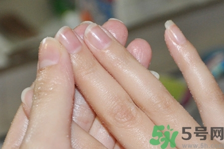 ?指甲上有豎紋是缺什么？指甲上有豎紋是缺維生素嗎？