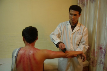 刮痧是什么原理？刮痧后需要注意什么？