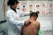 背部刮痧能祛痘嗎？背部刮痧需要注意什么？