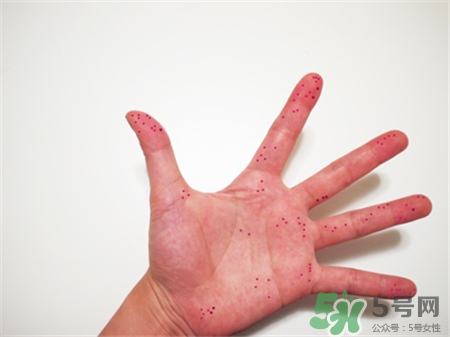 辣椒弄到鼻子上很辣怎么辦?辣椒弄到鼻子里怎么辦? 辣椒弄到鼻子上很辣怎么辦?辣椒弄到鼻子里怎么辦?