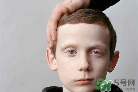 面癱能針灸嗎？針灸能治療面癱嗎？