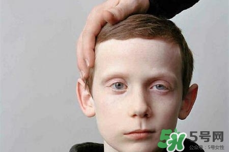 如何預(yù)防面癱復(fù)發(fā)？導(dǎo)致面癱的四大原因