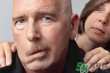 青少年面癱是怎么回事？青少年面癱是怎么辦？