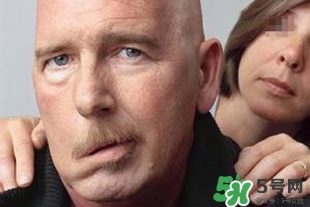 老年人為什么容易得面癱？老年人面癱原因有哪些？