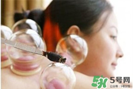 拔罐放血對身體好嗎？拔罐放血有什么好處？