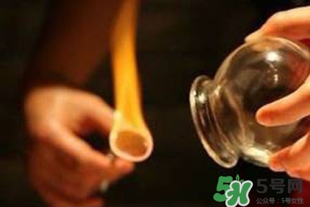 拔罐放血對身體好嗎？拔罐放血有什么好處？