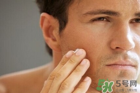 男人臉上酒刺怎么去掉？臉上長酒刺是怎么回事？