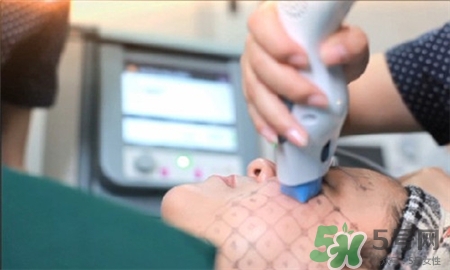 脈沖光會影響懷孕嗎?脈沖光的副作用 脈沖光會影響懷孕嗎?脈沖光的副作用