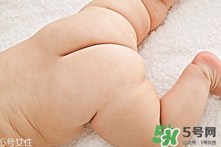 擴(kuò)肛疼嗎？擴(kuò)肛手術(shù)會(huì)很疼嗎？