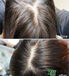 hairmax激光生發(fā)梳怎么用?hairmax激光生發(fā)梳使用心得 hairmax激光生發(fā)梳怎么用?hairmax激光生發(fā)梳使用心得