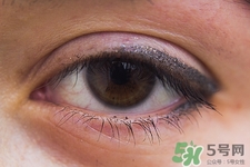 寶寶長針眼了怎么辦?寶寶長針眼怎么好的快 寶寶長針眼了怎么辦?寶寶長針眼怎么好的快