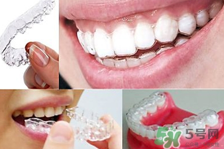 隱形牙套矯正多少錢？隱形牙套多少錢一副？