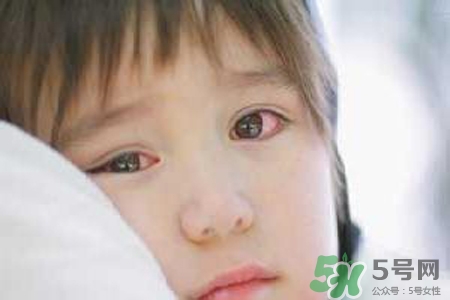 孩子為什么老眨眼睛？孩子總眨眼睛怎么回事？