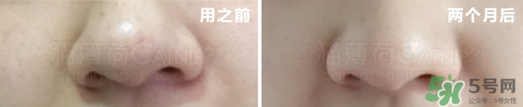 樂敦cc精華多少錢?樂敦cc精華日本專柜價格 樂敦cc精華多少錢?樂敦cc精華日本專柜價格