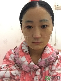 高麗雅娜肉毒桿菌使用方法 高麗雅娜肉毒桿菌怎么打開(kāi) 高麗雅娜肉毒桿菌使用方法 高麗雅娜肉毒桿菌怎么打開(kāi)