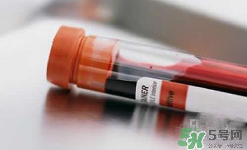 孩子沒出生可以做親子鑒定嗎？孩子沒出生怎么做親子鑒定？