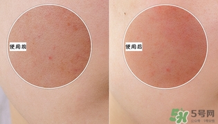 holika懶蛋蛋去角質多少錢？holika雞蛋去角質啫喱價格