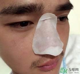 wis去黑頭套裝多少錢?wis去黑頭套裝價格 wis去黑頭套裝多少錢?wis去黑頭套裝價格