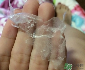 wis去黑頭套裝多少錢?wis去黑頭套裝價格 wis去黑頭套裝多少錢?wis去黑頭套裝價格