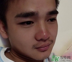 wis去黑頭套裝多少錢?wis去黑頭套裝價格 wis去黑頭套裝多少錢?wis去黑頭套裝價格