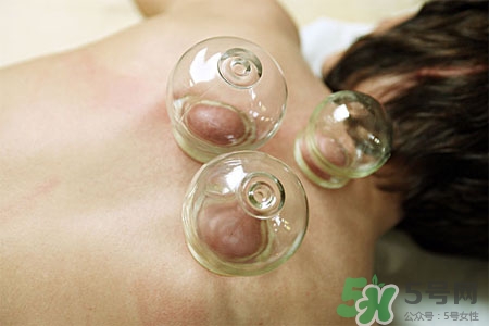 拔罐減肥為什么會(huì)反彈？拔罐減肥后不反彈的方法