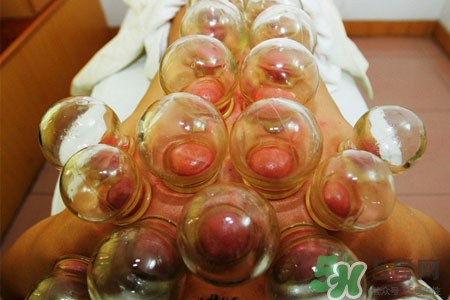 拔罐減肥為什么會(huì)反彈？拔罐減肥后不反彈的方法