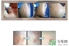 達(dá)爾膚dr.wu杏仁酸真假辨別方法 達(dá)爾膚dr.wu杏仁酸真假辨別方法