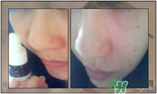 達(dá)爾膚dr.wu杏仁酸真假辨別方法 達(dá)爾膚dr.wu杏仁酸真假辨別方法