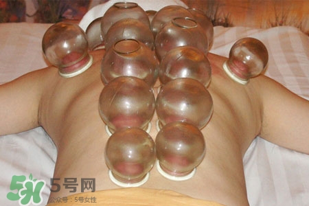 拔火罐會(huì)上癮嗎？拔火罐上癮了怎么辦？