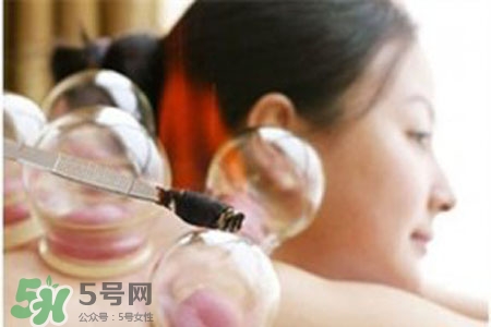 拔火罐后皮膚癢擦什么？拔火罐后皮膚癢怎么辦？