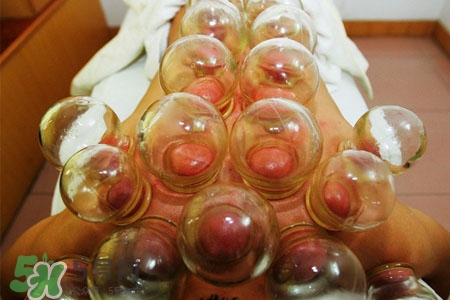 拔火罐后皮膚癢正常嗎？拔火罐后皮膚癢什么原因？