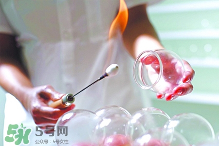 拔罐后可以貼膏藥嗎？拔罐后多久能貼膏藥？