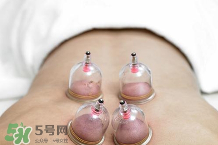 拔罐后可以泡澡嗎？拔罐后多久能泡澡？