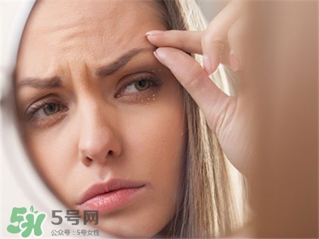 栗丘疹是怎么來的?栗丘疹和脂肪粒的區(qū)別 栗丘疹是怎么來的?栗丘疹和脂肪粒的區(qū)別