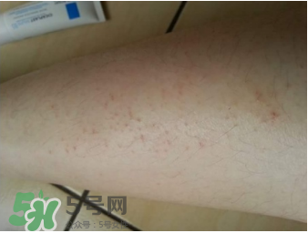 理膚泉b5修復(fù)霜怎么樣？理膚泉b5可以天天用嗎？