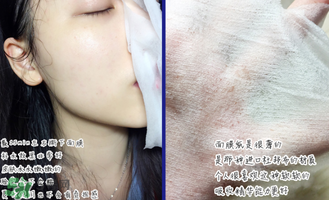 稚優(yōu)泉面膜怎么用？稚優(yōu)泉面膜要洗嗎？