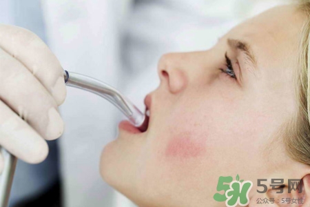 口含大蒜能治療咽炎嗎？巧用大蒜治療咽炎咳嗽