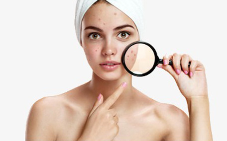 獅王祛痘膏怎么使用 獅王祛痘膏的使用方法