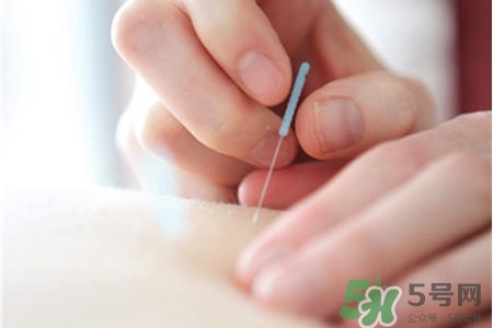 腰間盤突出可以針灸嗎？針灸能治腰間盤突出嗎？