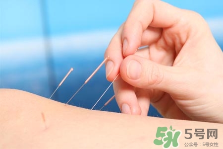 腰間盤突出可以針灸嗎？針灸能治腰間盤突出嗎？