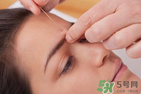 腰間盤突出可以針灸嗎？針灸能治腰間盤突出嗎？