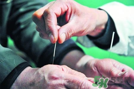 腰間盤突出可以針灸嗎？針灸能治腰間盤突出嗎？