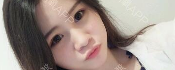 定點(diǎn)雙眼皮能保持多久？定點(diǎn)雙眼皮是永久的嗎？